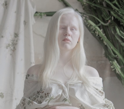 Лунная красота: девушка-альбинос из Челябинска покорила Москву и участвует в модных фотосессиях