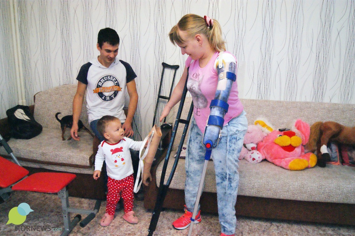 Какого жить без руки. Девочка инвалид без ноги. Дети инвалиды без рук и ног. Дети инвалиды без конечностей.